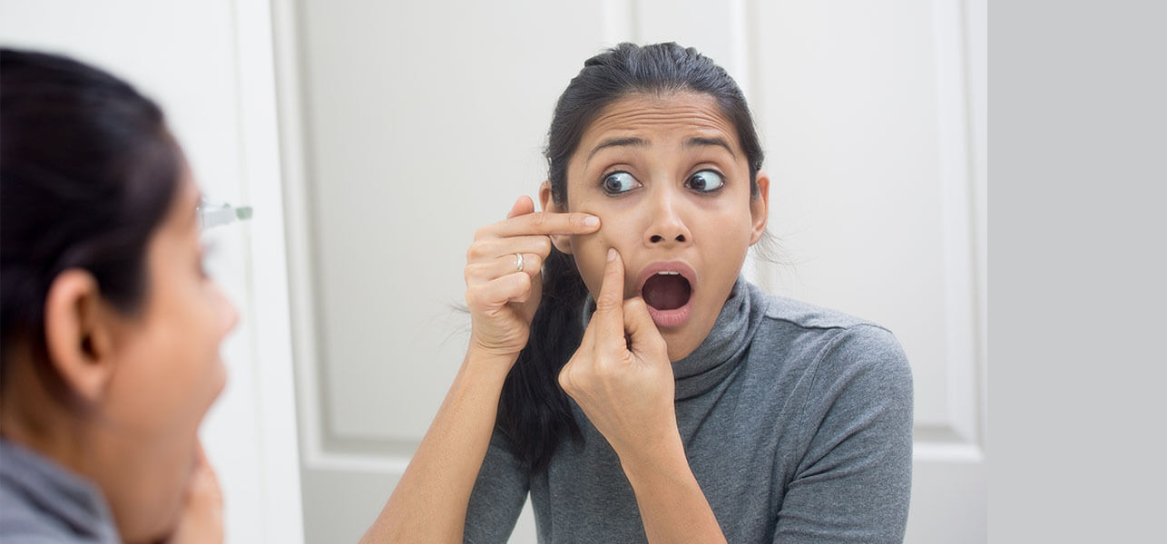 Causes of Pimple Scars and Easy Remedies to Get Rid of these