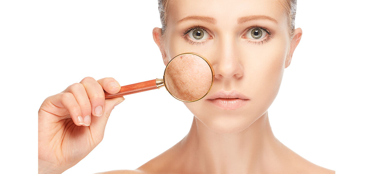 Goodbye to Pigmentation With Some Easy Remedies