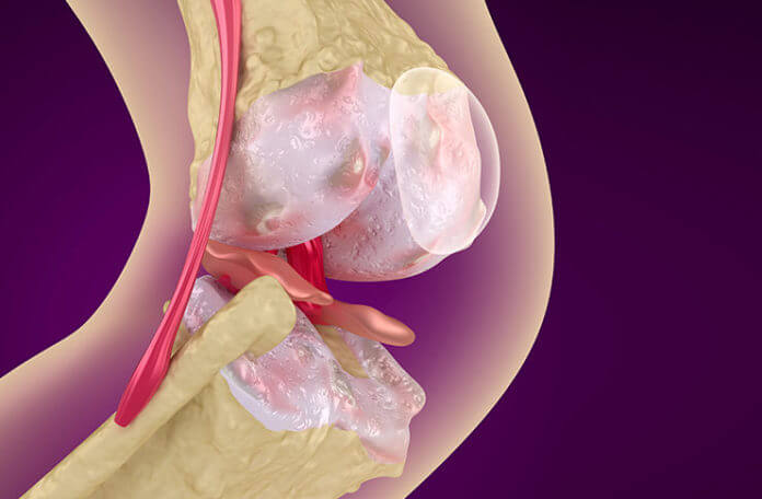 Did You Know That Weak Bones Could Be Osteoporosis?
