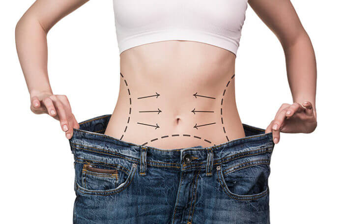 Weight Loss Surgery