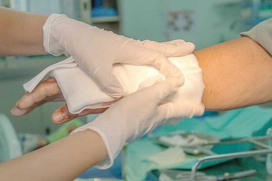 The Easiest Way to Treat Patients with Different Burn Degrees