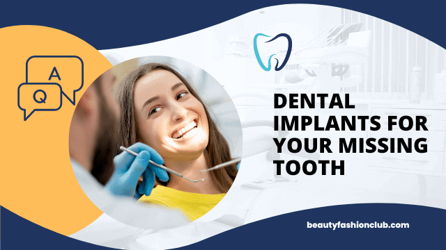 Dental Implants